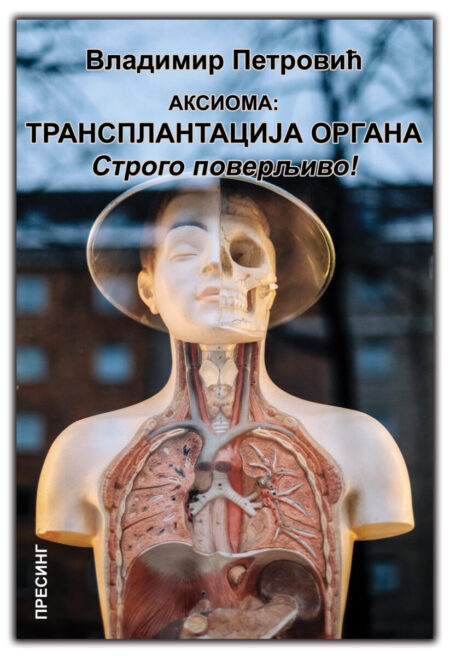 Aksioma: Transplantacija organa. Strogo poverljivo!